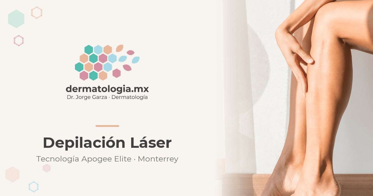 Preparación de la piel antes de la depilación láser en dermatologia.mx