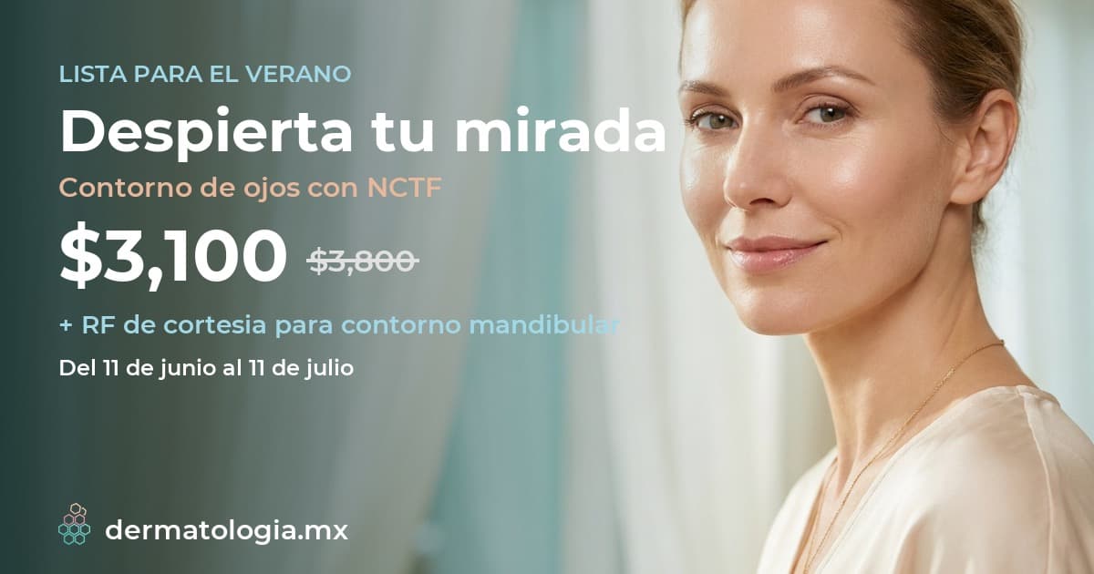 Contorno de ojos con NCTF