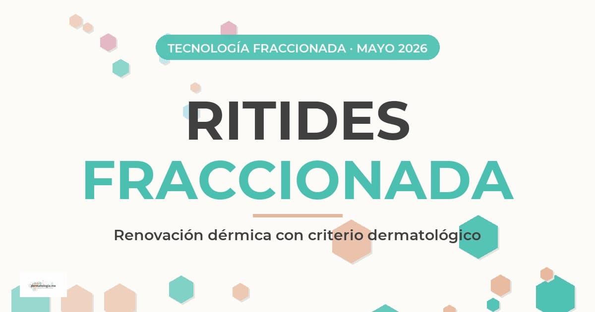Ritides Fraccionada