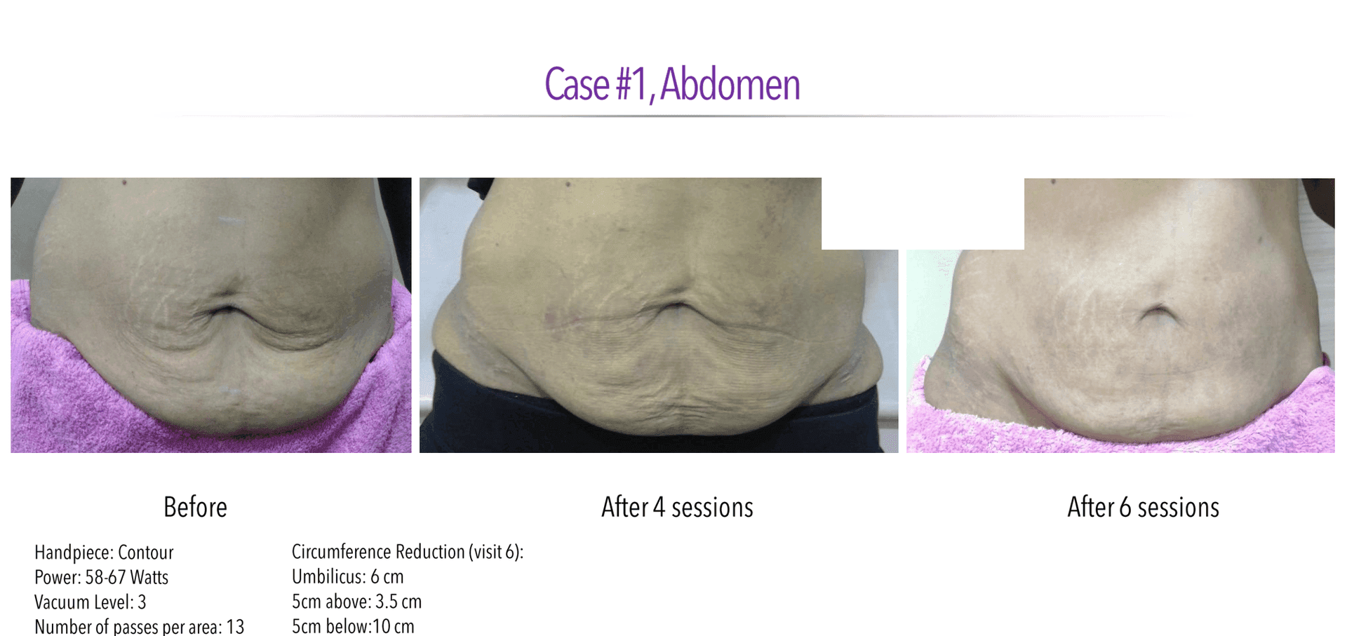 Caso clínico — Abdomen — progresión de sesiones
